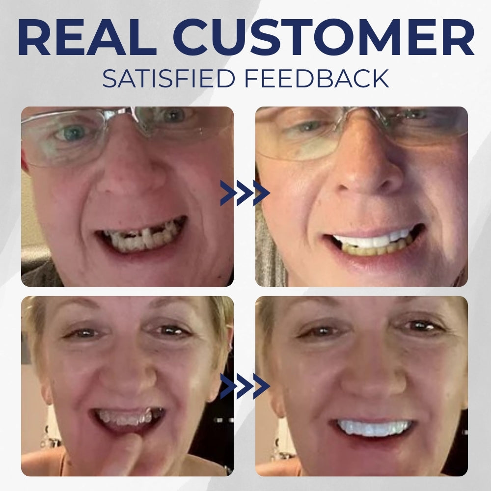 Hidone™ - Full Denture Set